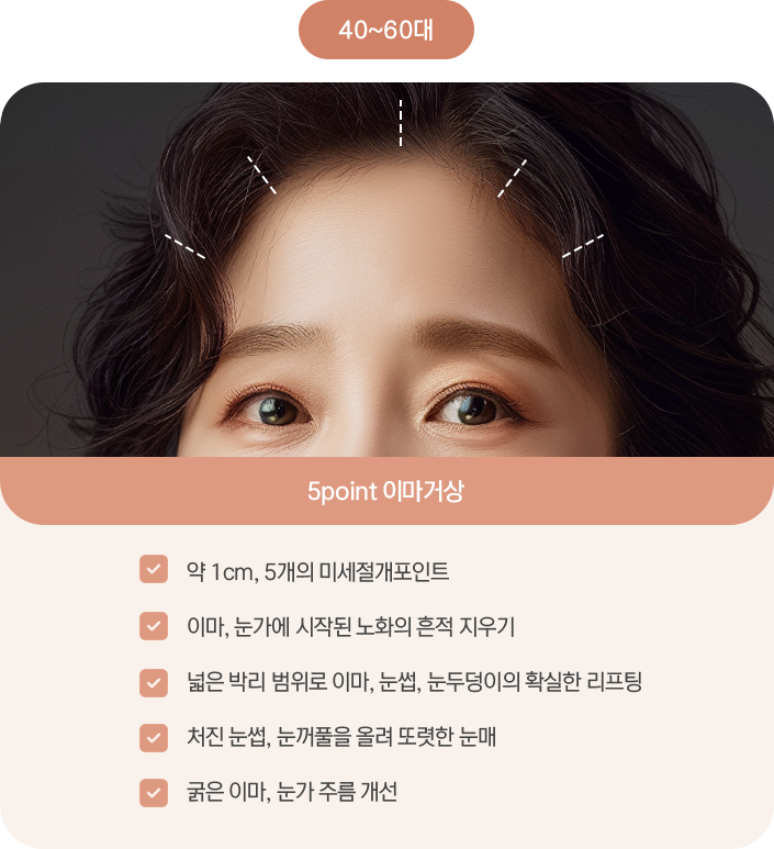 내시경 이마거상 미세절개 포인트 — 이마, 눈가에 시작된 노화의 흔적 지우기