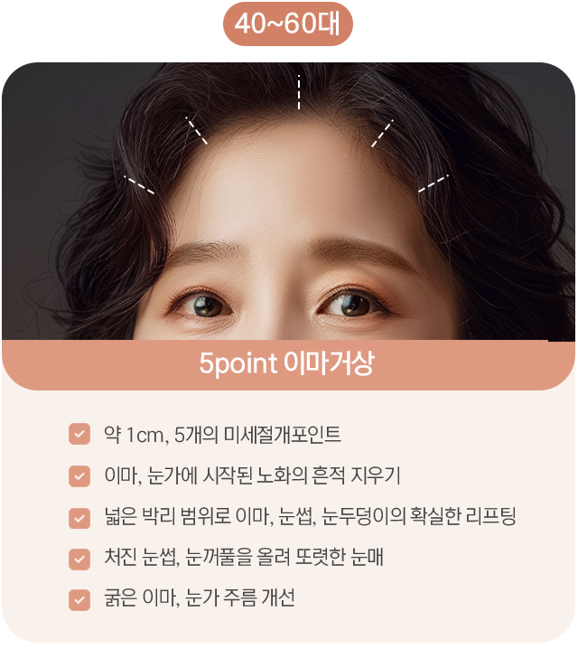 내시경 이마거상 미세절개 포인트 — 이마, 눈가에 시작된 노화의 흔적 지우기