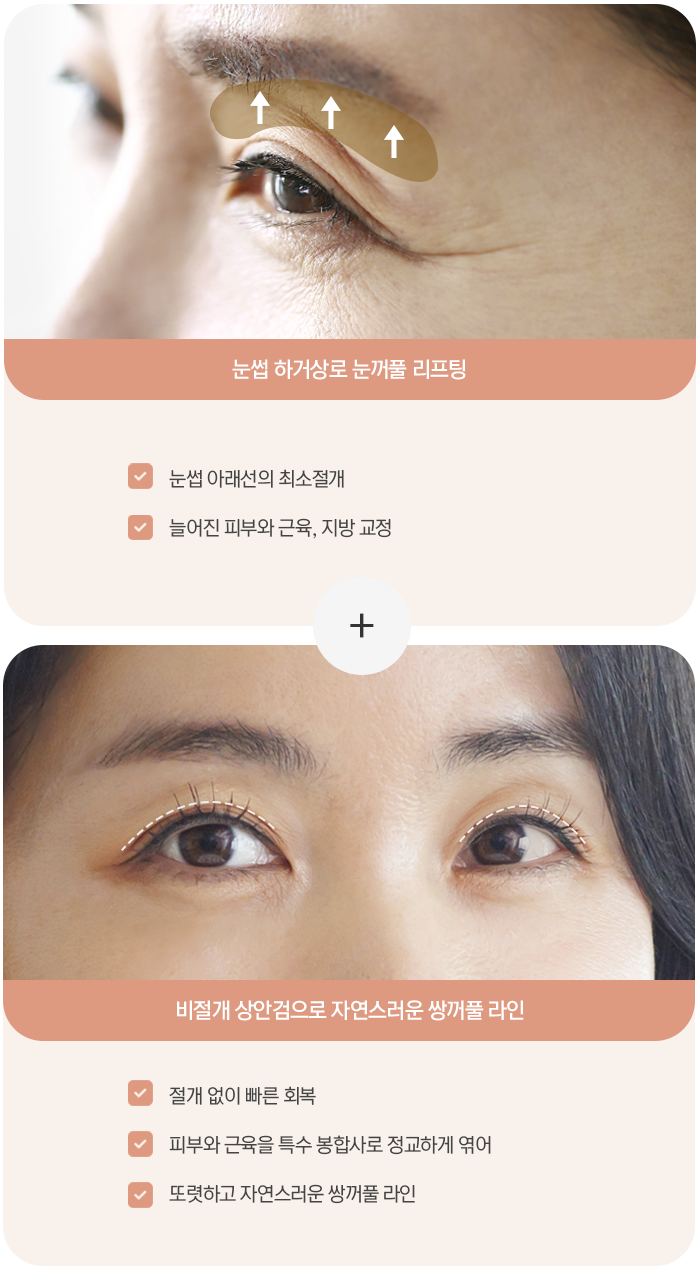 눈썹하거상 + 비절개 상안검 — 눈썹 아래선의 최소절개, 늘어진 피부와 근육·지방 교정, 피부와 근육을 특수 봉합사로 정교하게 엮어 또렷하고 자연스러운 쌍꺼풀 라인, 절개 없이 빠른 회복