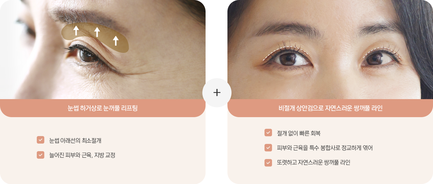 눈썹하거상 + 비절개 상안검 — 눈썹 아래선의 최소절개, 늘어진 피부와 근육·지방 교정, 피부와 근육을 특수 봉합사로 정교하게 엮어 또렷하고 자연스러운 쌍꺼풀 라인, 절개 없이 빠른 회복